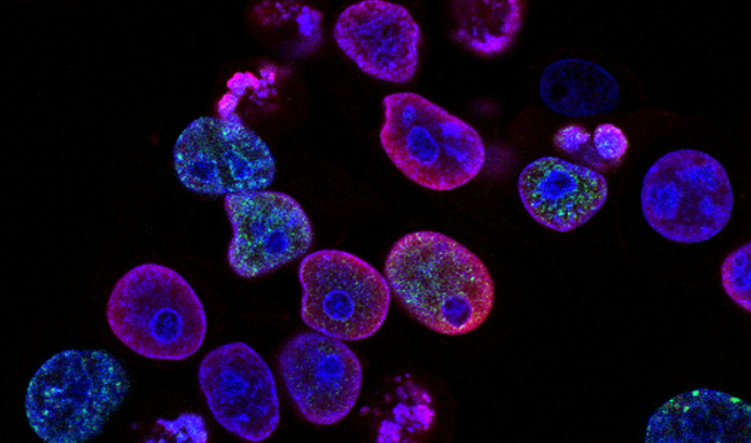 Fluorescence microscopy image showing clusters of human cells with brightly colored nuclei and cellular structures against a black background.